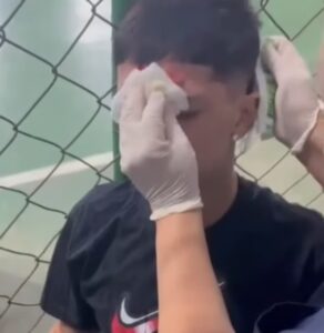 Daniel Pacheco no vestiário após o incidente