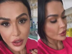 Gracyanne Barbosa fala sobre ganho de peso e exibe joelho 14 dias após cirurgia