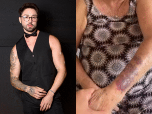 Rico Melquiades denuncia agressão sofrida por tia e avó: “Tentativa de feminicídio”