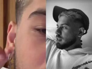 Zé Felipe realiza novo procedimento após acidente doméstico: "Não cuidei e deu isso"