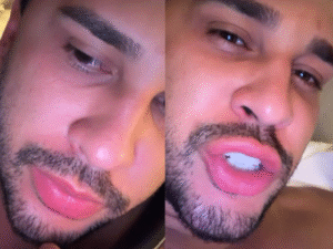 Lucas Guimarães se assusta com gritos em hotel e chama a polícia: “Tremendo todo”